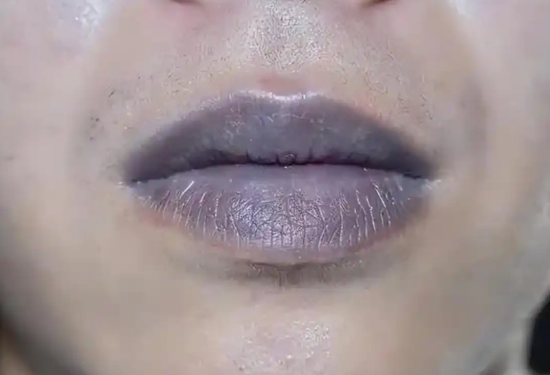 脑梗预警数据揭秘:95%的患者忽视了这4个关键异常信号 健康养生